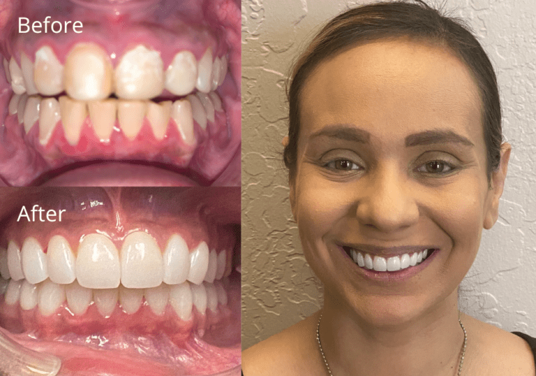 Smile Gallery ProSmile Dental Implant Center